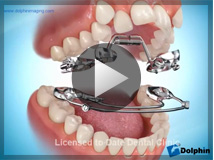 四谷見附矯正歯科 顎顔面矯正クリニック | 顎顔面矯正治療とは