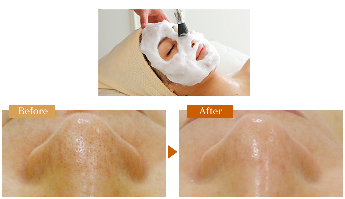 毛穴リメイクプロ | サロンド ア モール