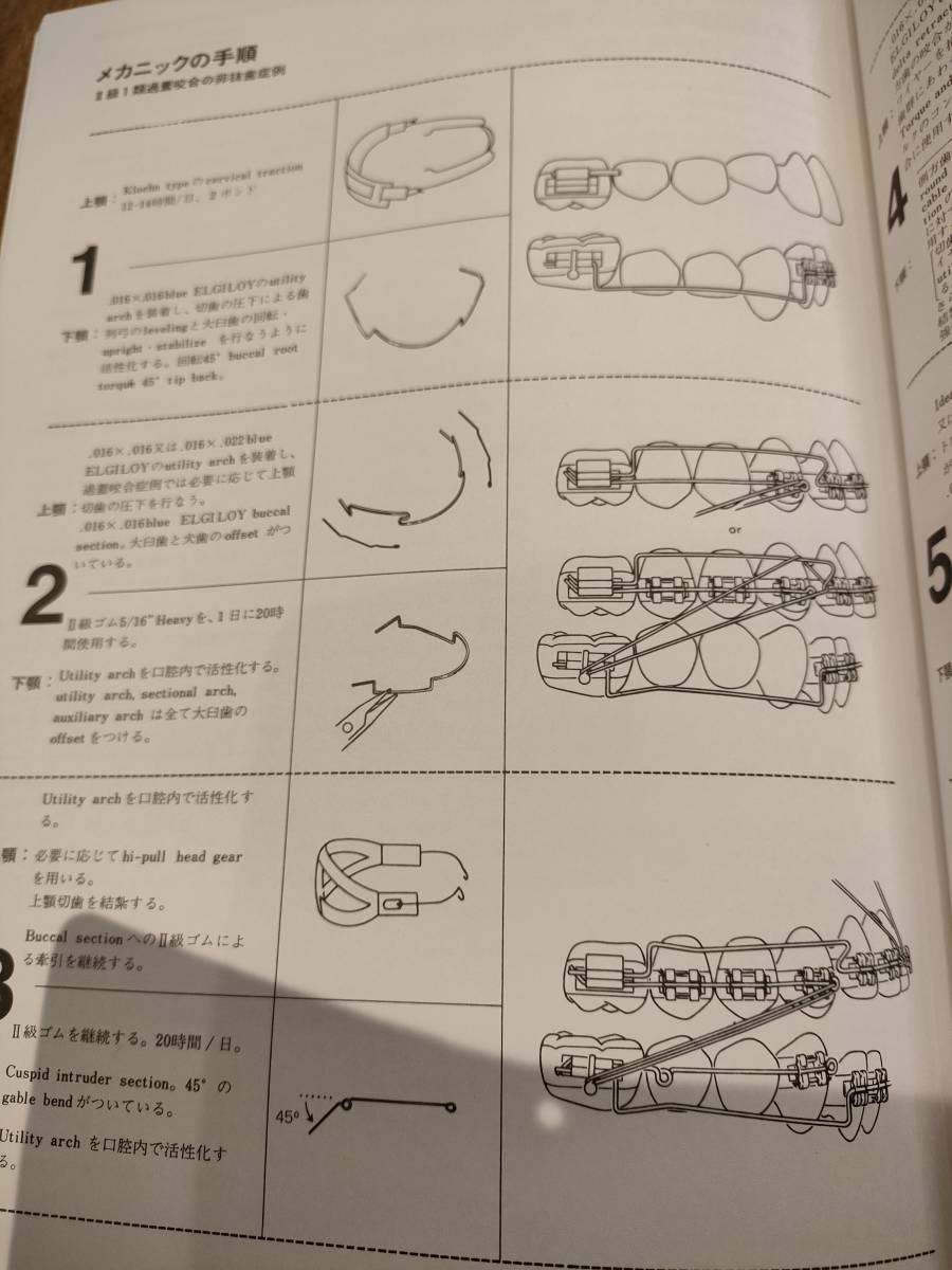 バイオプログレッシブテクニックと理論 歯科 矯正 Bioprogressive