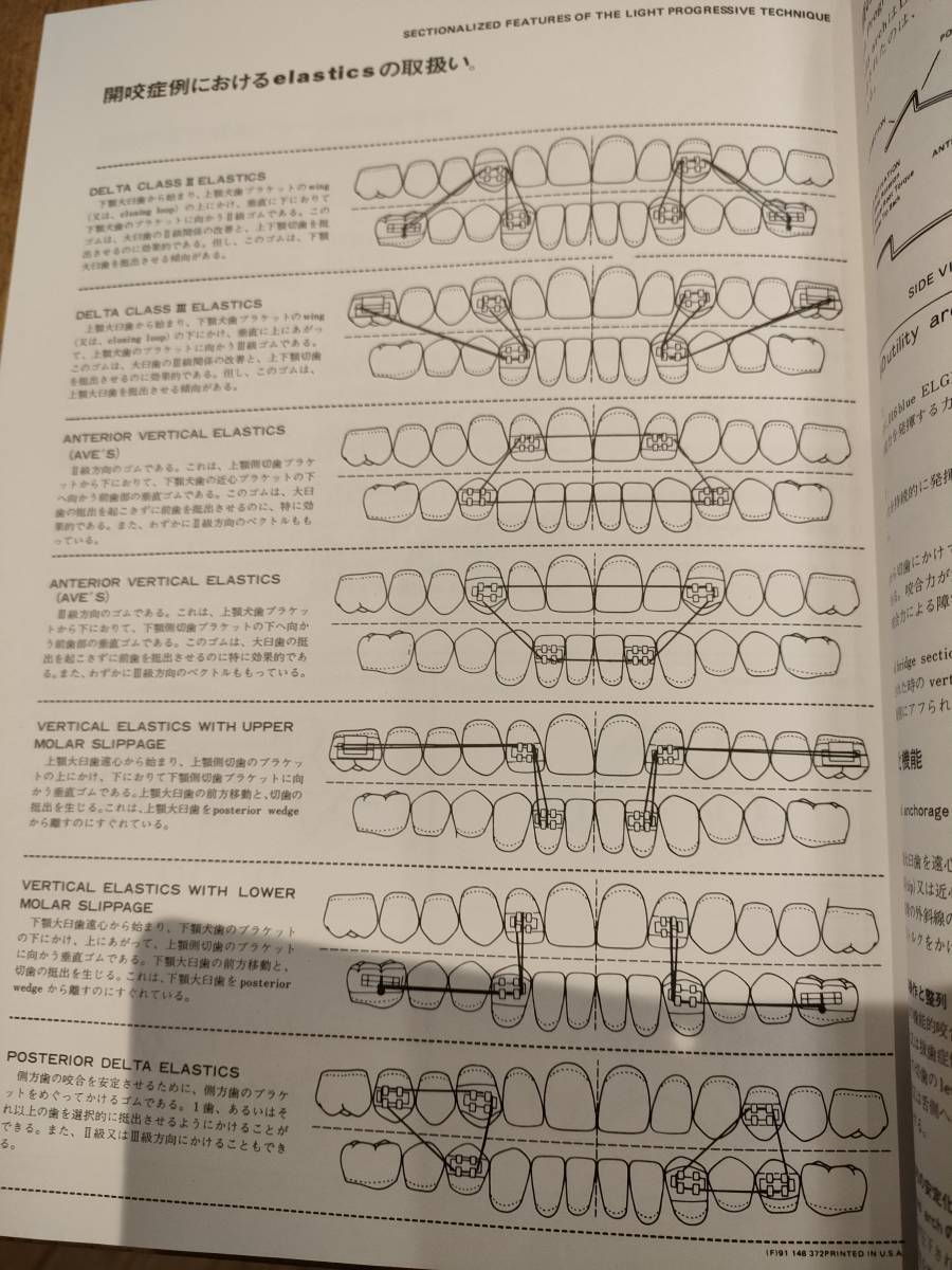 バイオプログレッシブテクニックと理論 歯科 矯正 Bioprogressive