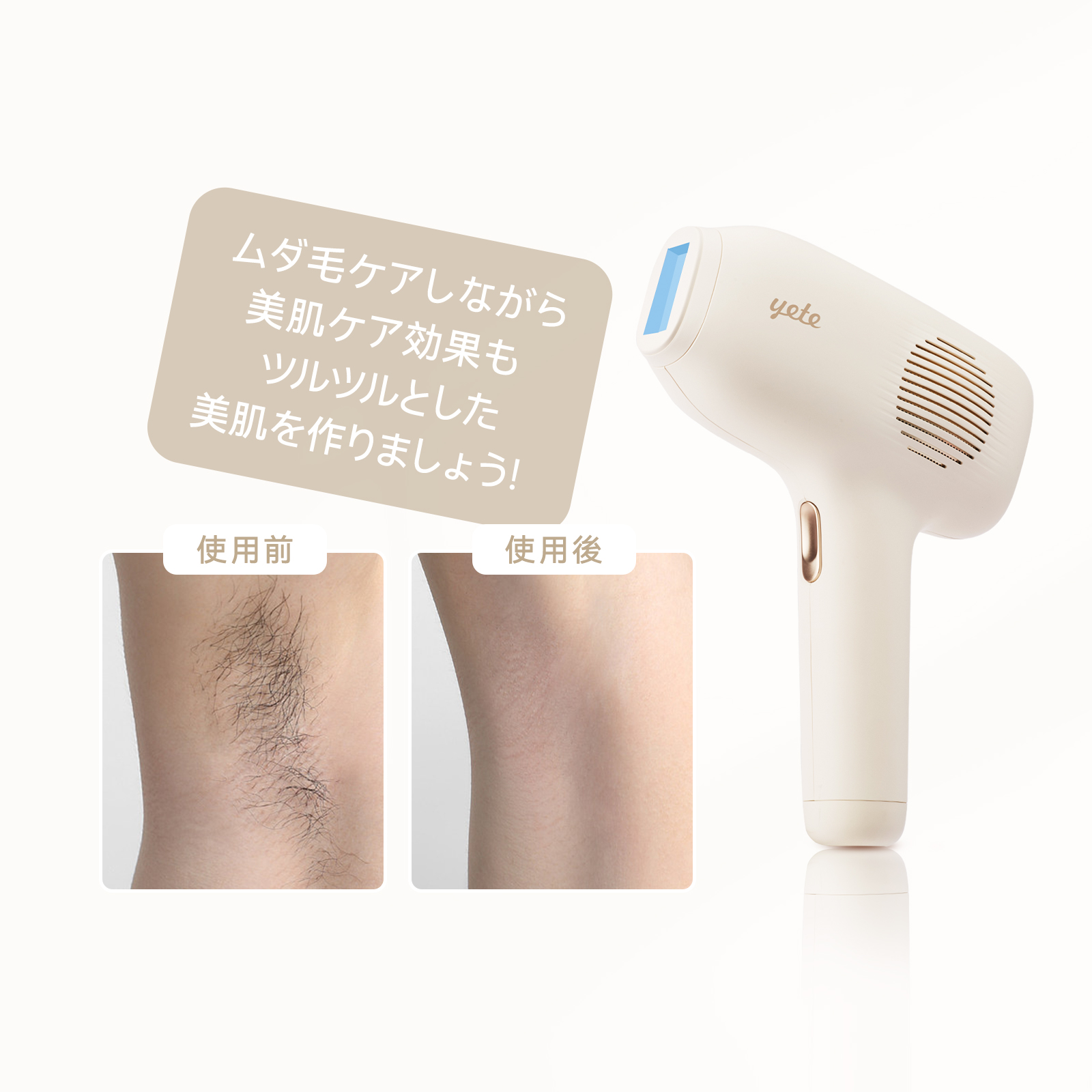 yete（エイティー）脱毛器 ipl サファイア冷却技術 ☆男女兼用 ゲ脱毛