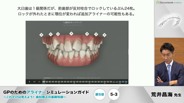 GPのためのアライナーシミュレーションガイド 〜これだけは覚えよう