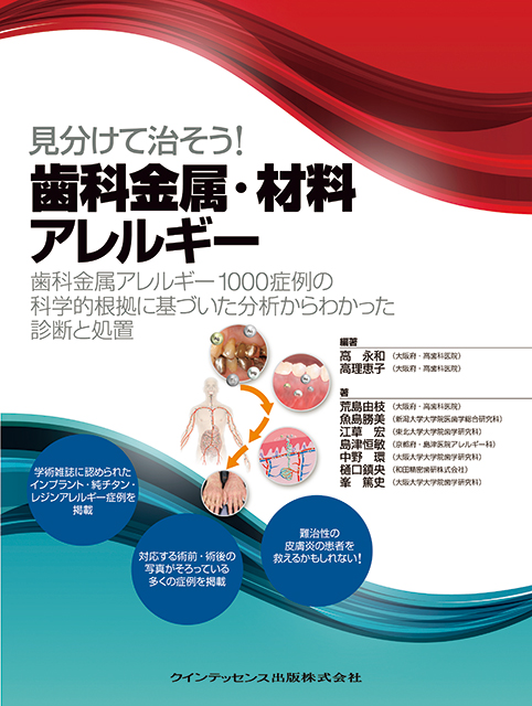 見分けて治そう！ 歯科金属・材料アレルギー - クインテッセンス出版