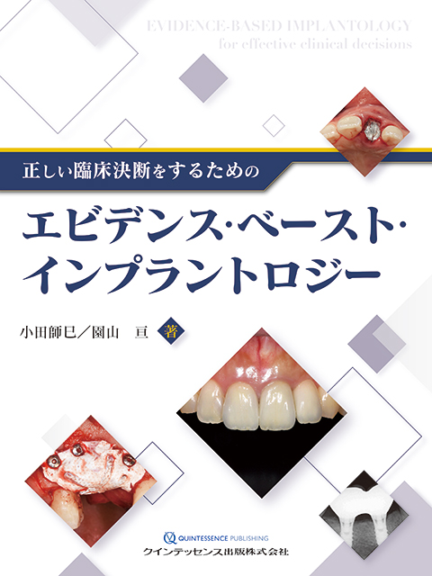 新時代の歯周外科 - クインテッセンス出版