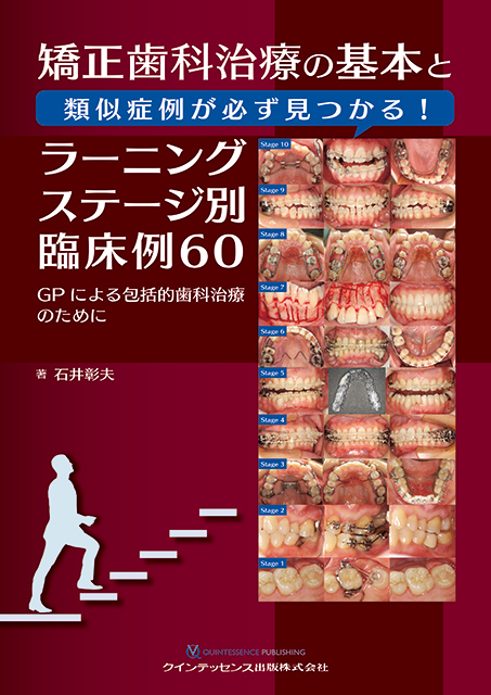 加速矯正による治療期間短縮のコンセプト - クインテッセンス出版