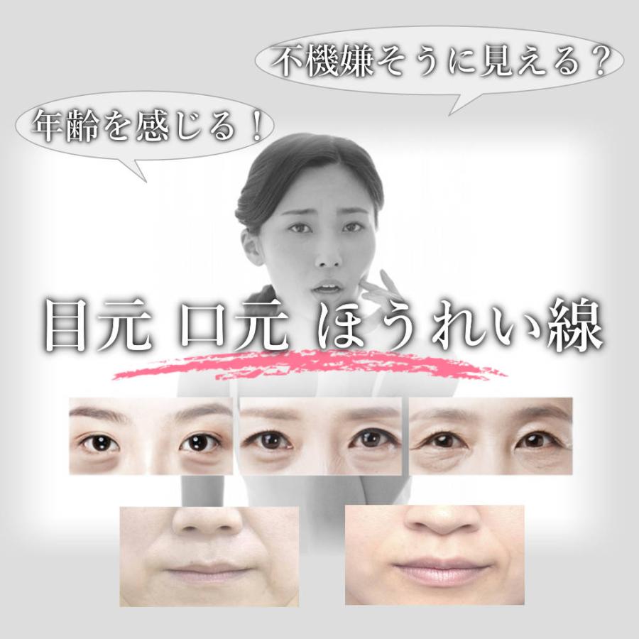 美顔器 ems リフトアップ効果 目元ケア ほうれい線 たるみ リフト