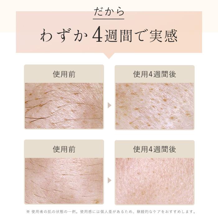 STELLA BEAUTE公式 IPL光美容器Luna (ルナ)ムダ毛ケア 美肌ケア 家庭用