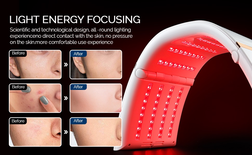 Amazon.com : foreverLily Face Skincare Machine, 7 Colors Facial