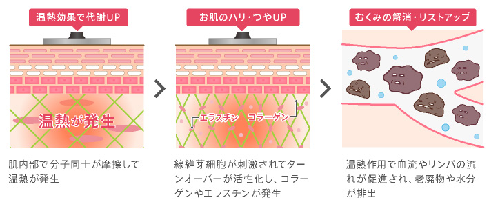 ラジオ波(RF)の効果を徹底調査！痩せるコツ＆マシンの選び方