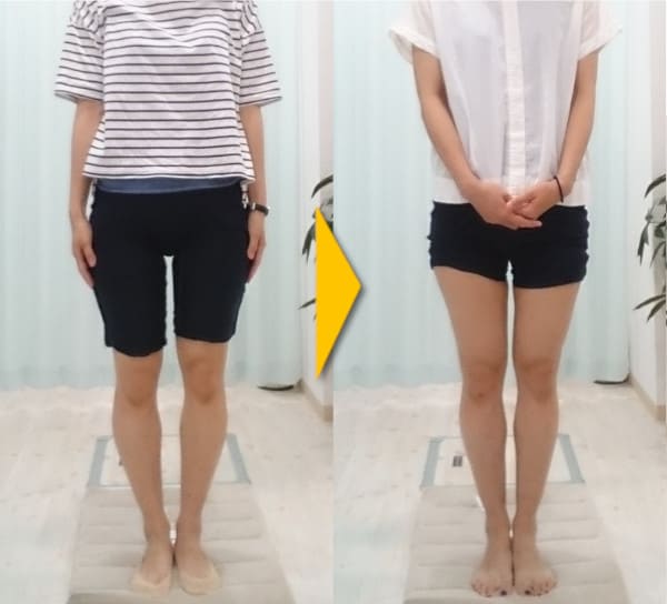 O脚矯正は大阪府池田市の『整体院 そるん』