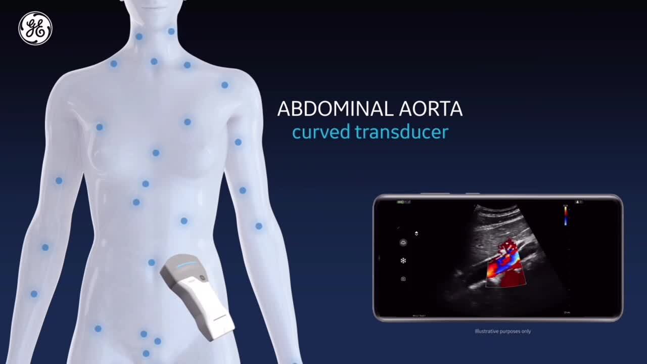 Vscan Air CL | GE HealthCare (Japan)