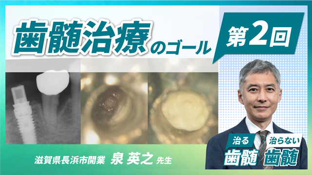 治る歯髄 治らない歯髄 - 歯髄保存の科学と臨床 - 第1回 「なぜ歯髄